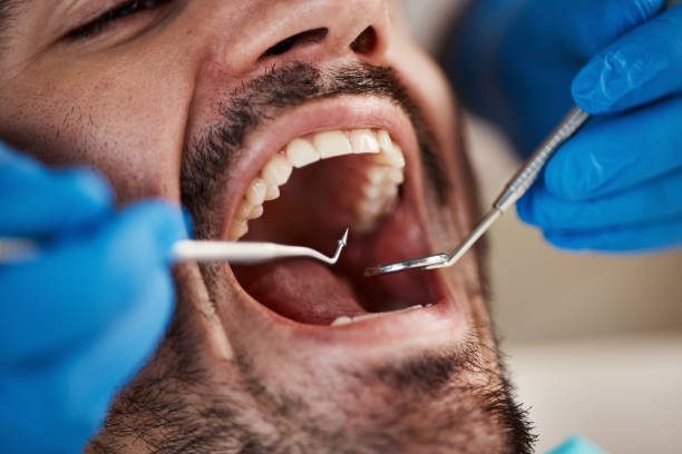 Best Pediatric Emergency Dentist in Cataula, GA